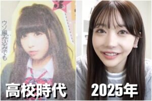 Rちゃんの整形前は?目と鼻をやりすぎて失敗したのか画像比較で検証!