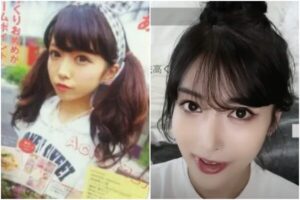 Rちゃんの整形前は?目と鼻をやりすぎて失敗したのか画像比較で検証!