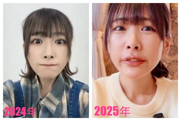 えびまよの整形前は?鼻や顔が変わったのはいつからなのか画像比較!