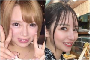 進撃のノアの整形前の昔の顔は？変わった箇所はどこなのか画像比較で検証！