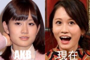 前田敦子の整形前は?エラ・鼻・まぶたの変化で顔が変わったのか画像比較!