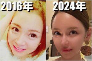 進撃のノアの整形前の昔の顔は？変わった箇所はどこなのか画像比較で検証！