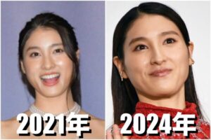 土屋太鳳が整形失敗？エラを削って鼻も変わったのか画像比較で検証！