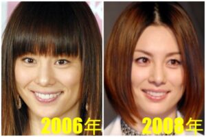 米倉涼子の整形前は?鼻や顔変わったのか画像比較で検証!