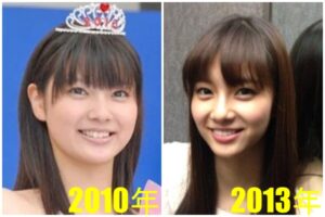 新川優愛の整形前は？顔変わったのか画像比較で検証！