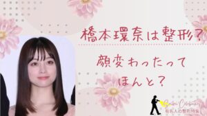 橋本環奈は整形してる?顔変わったのか画像比較で検証!