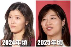 ヒコロヒーは整形してる？顔変わったのか画像比較で検証！