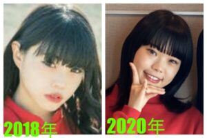 アイナジエンドは整形してる？顔変わったのか画像比較で検証！