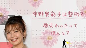 宇野実彩子は整形してる？顔変わったのか画像比較で検証！