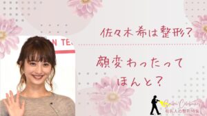 佐々木希は整形してる?顔変わったのか画像比較で検証!