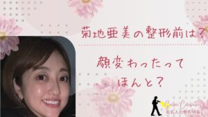 菊地亜美の整形前は？顔変わったのか画像比較で検証！