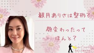 観月ありさは整形してる？顔変わったのか画像比較で検証！