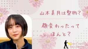 山本美月は整形してる？顔変わったのか画像比較で検証！