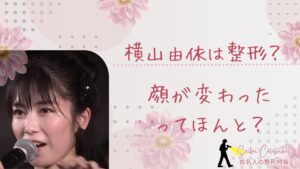 横山由依は整形してる?顔が変わったのか画像比較で検証!