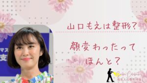 山口もえは整形してる？顔変わったのか画像比較で検証！