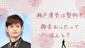 瀬戸康史は整形してる？顔が変わったのか画像比較で検証！