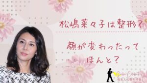 松嶋菜々子は整形してる？顔変わったのか画像比較で検証！