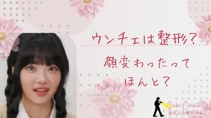 ウンチェは整形してる？顔変わったのか画像比較で検証！