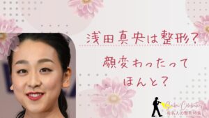 浅田真央は整形してる？顔変わったのか画像比較で検証！