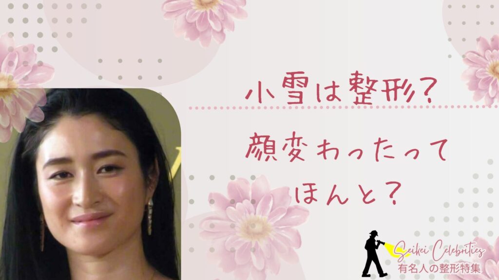 小雪は整形してる？顔変わったのか画像比較で検証！