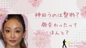 神田うのは整形してる？顔変わったのか画像比較で検証！