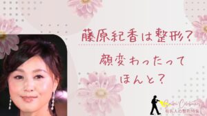 藤原紀香は整形してる？顔変わったのか画像比較で検証！